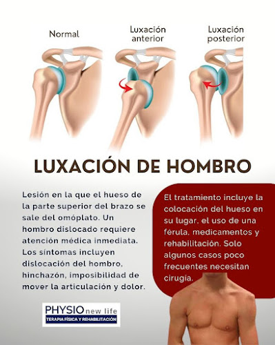 Terapia Física a Domicilio - Magdalena del Mar