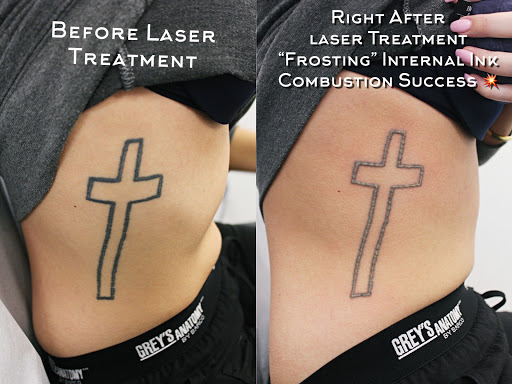 Explore firefighting tattoo ideas, creative tattoo ideas in Amarillo, available at Progress MD Tattoo Removal