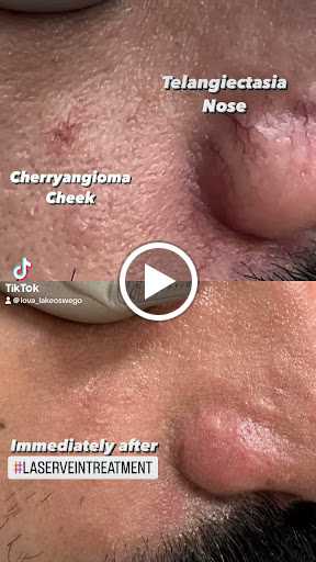 Explore pilot tattoo ideas, creative tattoo ideas in Lake Oswego, available at Lake Oswego Vein and Aesthetic LOVA