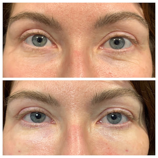 Explore destiny 2 hunter tattoo ideas, creative tattoo ideas in Portland, available at Oregon Medical & Laser (formerly Cascade Medical & Tattoo Removal)