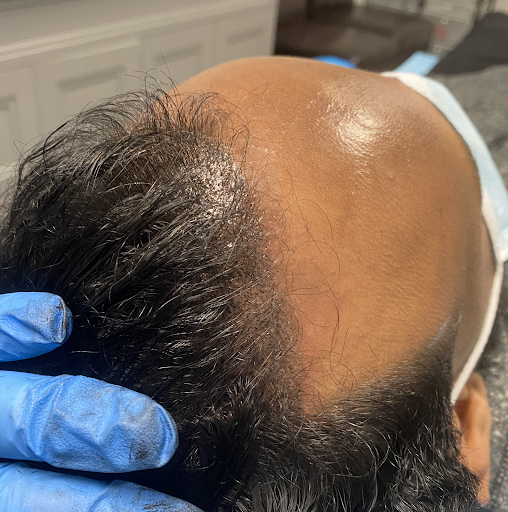 Explore witch tattoos ideas, creative tattoo ideas in Minneapolis, available at Medical Tattoo & Cosmetic Centers of America