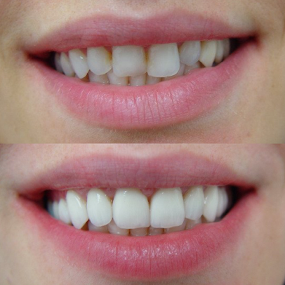 Dent Artistry Contemporary Prosthodontics - Dent Artistry Contemporary Prosthodontics