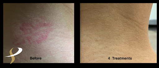 Explore warrior tattoo sleeve ideas, creative tattoo ideas in Spokane, available at Premier Body and Laser