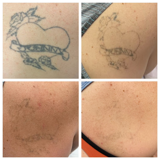 Explore mens collar bone tattoo ideas, creative tattoo ideas in Allen, available at Shipers Laser Tattoo Removal Center Dallas