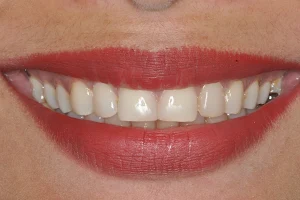 The Perfect Smile Dental Clinic image