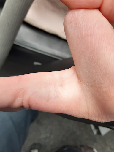 Explore blue flame tattoo ideas, creative tattoo ideas in Saint Paul, available at Fearless Tattoo Removal