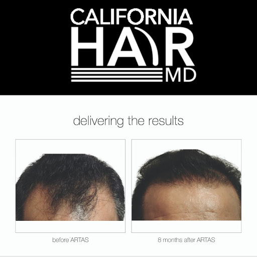 California Hair MD: La Jolla Hair Restoration
