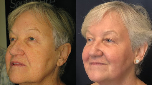 White Rock Skin and Laser Clinic - White Rock Skin and Laser Clinic