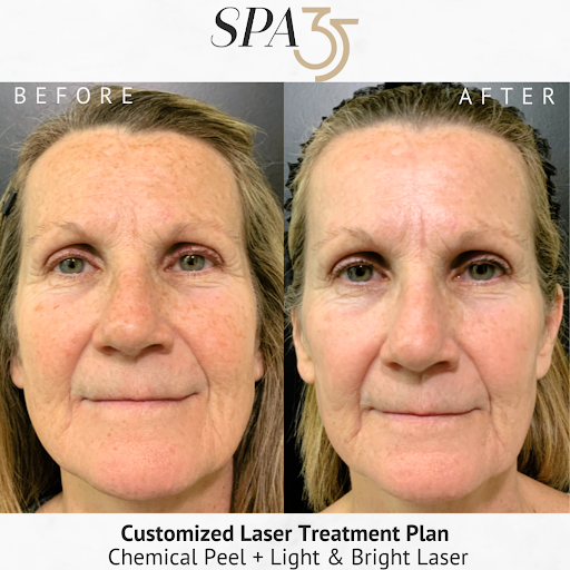 Explore back of the thigh tattoo ideas, creative tattoo ideas in Boise, available at Spa 35 Med Spa