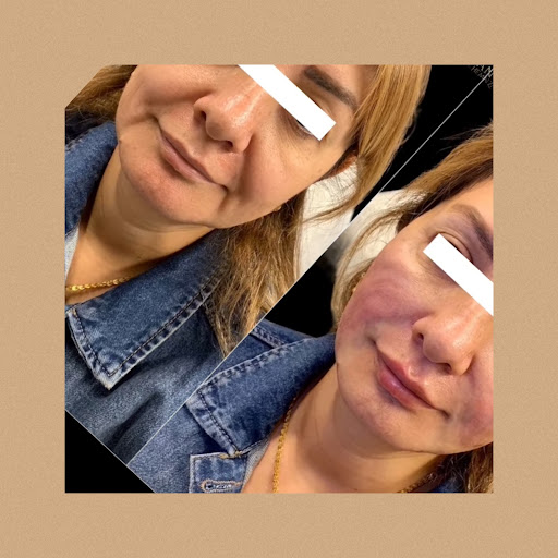 Medical Spa «Lavender Med Spa», reviews and photos, 3675 Crestwood Pkwy #400, Duluth, GA 30096, USA