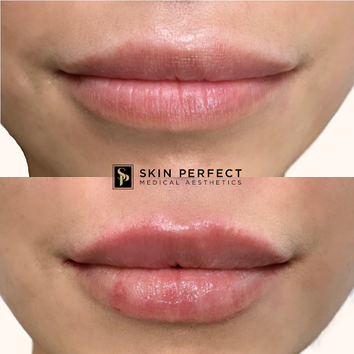 Explore patchwork ideas tattoos, creative tattoo ideas in Whittier, available at Skin Perfect Medical Aesthetics