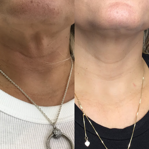 Find aztec tattoo ideas for your next unique tattoo in Canton at JDV Med Spa