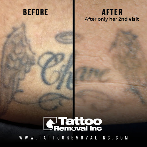 Explore women sleeve tattoo ideas, creative tattoo ideas in South Gate, available at Tattoo Removal Inc