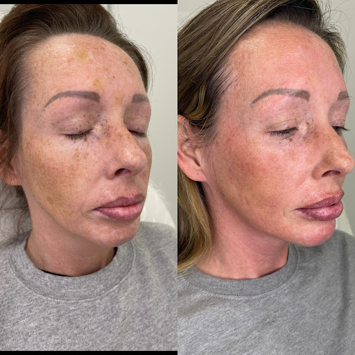 Explore miscarriage tattoo ideas, creative tattoo ideas in Owensboro, available at The Skin Lab