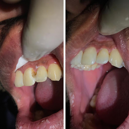 Kumaun Dental Care Clinic - Kumaun Dental Care Clinic