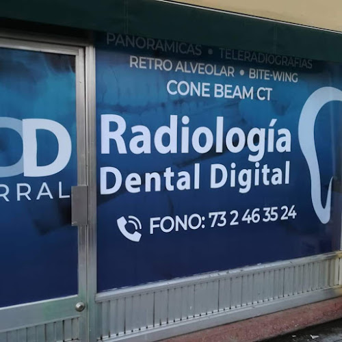 RDD, Radiologia Dental, Parral - Parral