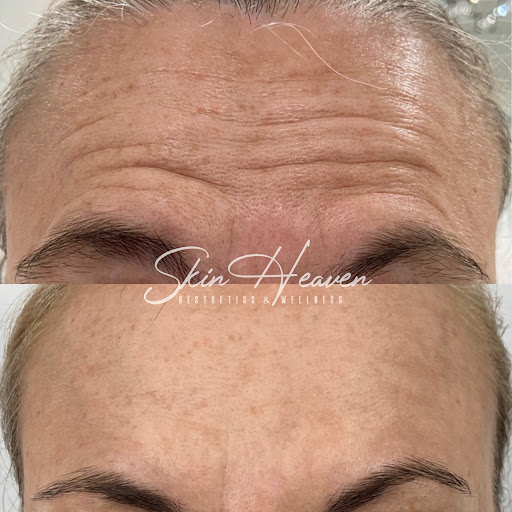 Skin Heaven Aesthetics and Wellness image
