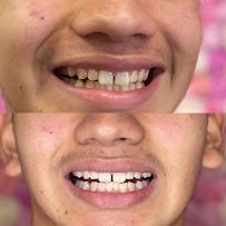 Aesthetics With Amor - Photo 2 - Car repair in Fresno, CA, Fresno