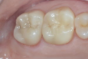 Punta Cana Oral Health image