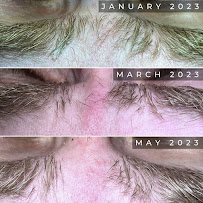 TS ELECTROLYSIS - Photo 5 - Car repair in Vancouver, WA, Vancouver