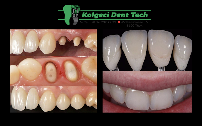 Kolgeci Dent Tech - Zahnarzt