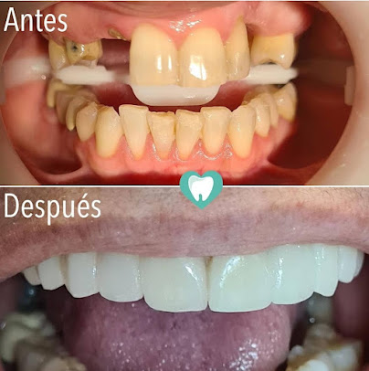 DentalHD Odontologia de Alta Estetica - DentalHD Odontologia de Alta Estetica