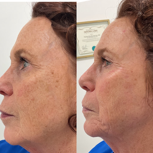 Explore female big tattoo ideas, creative tattoo ideas in Owensboro, available at The Skin Lab