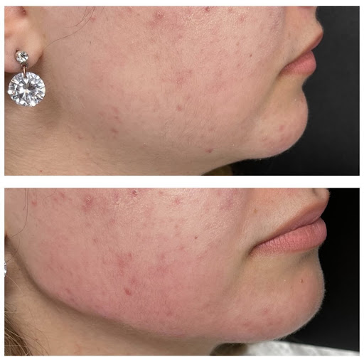 Medical Spa «Lavender Med Spa», reviews and photos, 3675 Crestwood Pkwy #400, Duluth, GA 30096, USA