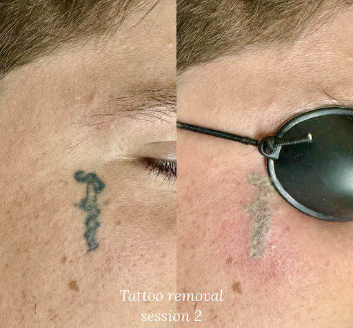 Explore ladies side tattoo ideas, creative tattoo ideas in Savannah, available at Haute Brows. Cosmetic Tattoo