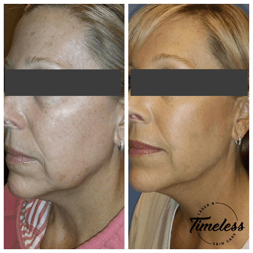 Skin Care Clinic «Timeless Laser & Skin Care», reviews and photos, 29160 Center Ridge Rd, Westlake, OH 44145, USA
