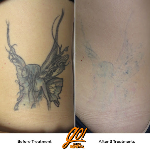 Explore simple first tattoo ideas for guys, creative tattoo ideas in Allentown, available at Removery Tattoo Removal & Fading