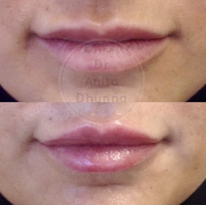 Dr Anita Dhunna, Beauty In The Park - Dr Anita Dhunna, Beauty In The Park