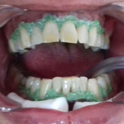 Consultorio Odontológico Dra. Ana Lía Font - Dentista