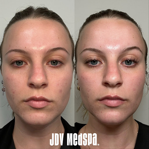 Explore rocky tattoo ideas, creative tattoo ideas in Canton, available at JDV Med Spa