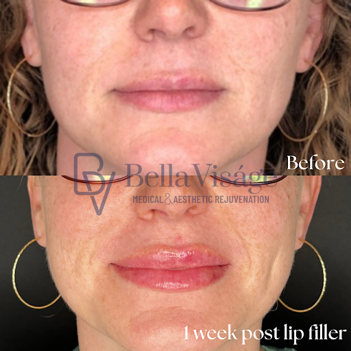 Explore tribal half sleeve tattoo ideas, creative tattoo ideas in Lakeland, available at Bella Visge Medical & Aesthetic Rejuvenation