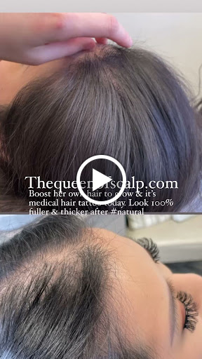 SMP Hair Clinic The Queen Of Scalp image