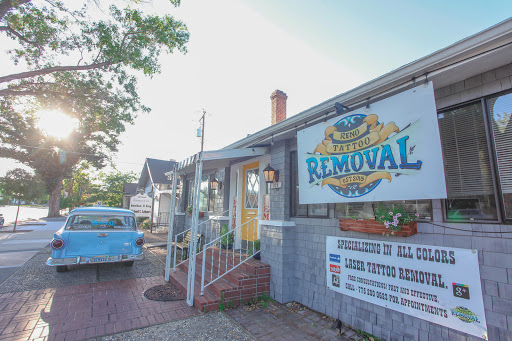 Explore wild idea tattoo, creative tattoo ideas in Reno, available at Reno Tattoo Removal