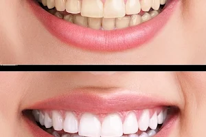 Elate Smiles Dental Clinic image