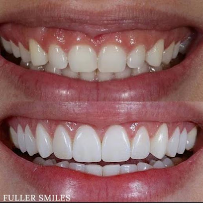 Fuller Smiles - Dentist - Culver City