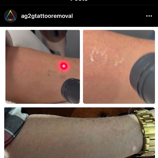 Explore psych tattoo ideas, creative tattoo ideas in New York, available at Ag2g Laser Tattoo Removal & MedSpa