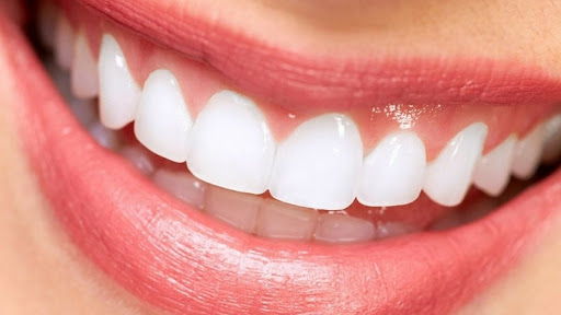 Eira Dental - Dentistas y brackets en Querétaro