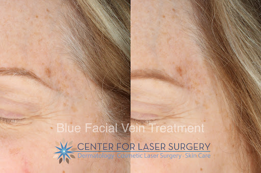 Explore mushroom tattoo ideas, creative tattoo ideas in Washington, available at Center For Laser Surgery