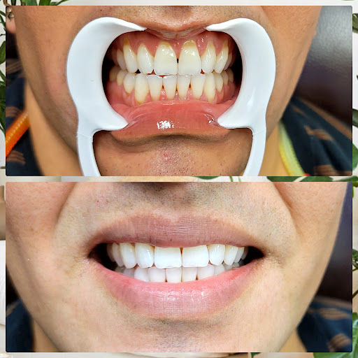 Explore race car tattoo ideas, creative tattoo ideas in Bakersfield, available at Skin Kings Tattoo