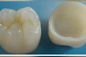 Delight Dental Care - Dr Madhulika Tewari. Barowaritala. Keshtopur image