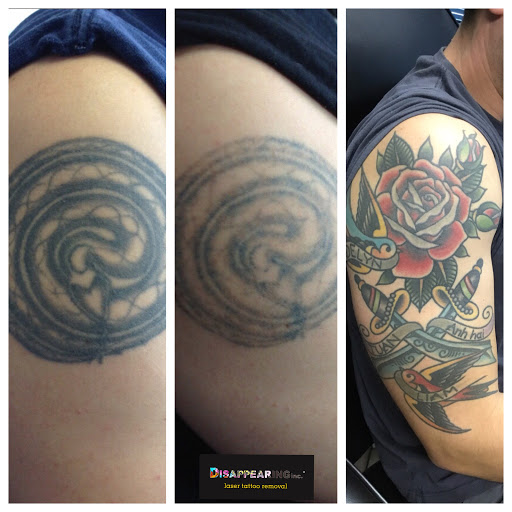 Explore alabama tattoo ideas, creative tattoo ideas in Lawrence, available at Removery Tattoo Removal & Fading