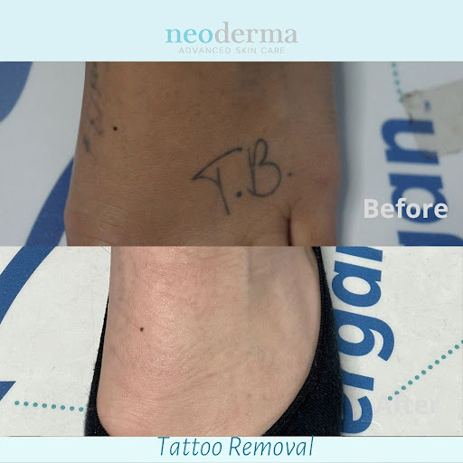 Explore deer antler tattoo ideas, creative tattoo ideas in Anaheim, available at Neoderma