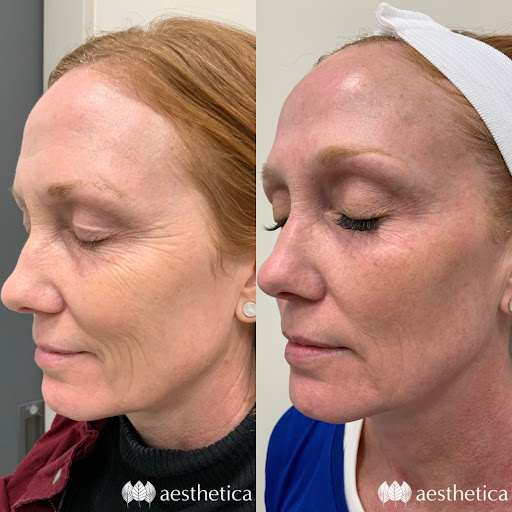 Explore abortion tattoos ideas, creative tattoo ideas in Pleasant Grove, available at Aesthetica