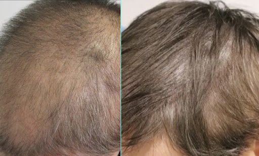 Explore mens chest tattoo ideas small, creative tattoo ideas in Conroe, available at Institute 28