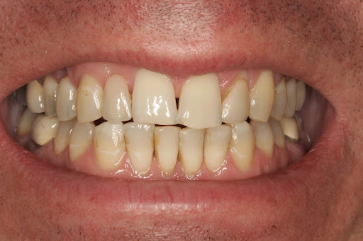 Dentist «Dentistry In Bellevue», reviews and photos