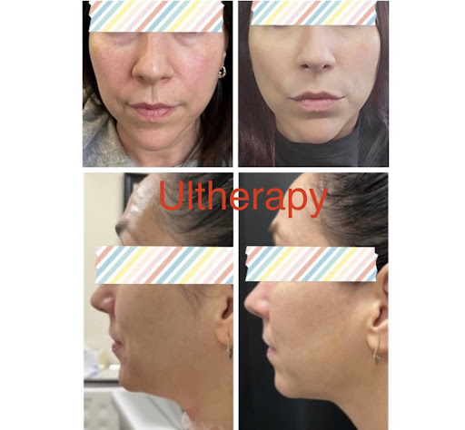 Bellatudo Skin and Wellness Center image
